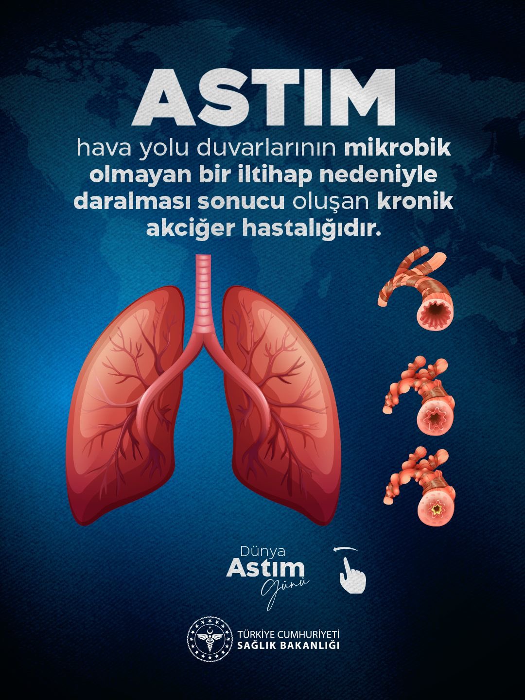 Astım kontrolü için 6 altın kural önerisi