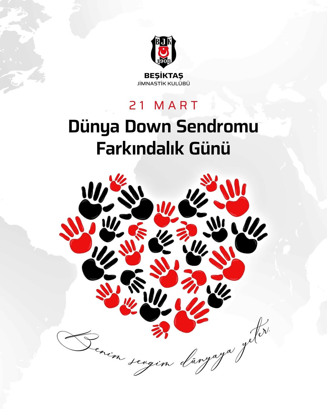 Down Sendromu: Eksiklik Değil, +1 Fazlalıktır!