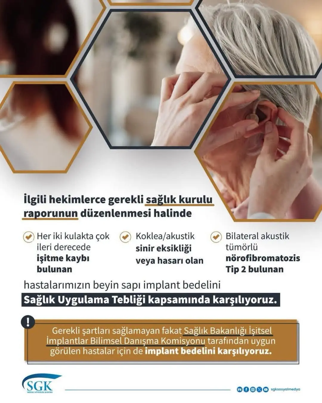 Afyonkarahisar Sgk İl Müdürlüğü Açıkladı: Beyin Sapı İmplant Bedeli Hangi Durumlarda Karşılanıyor?